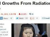bambini Fukushima hanno crescite anomale esposizione radiazioni