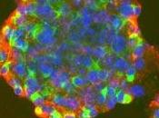 Cellule staminali dalla polpa denti giudizio