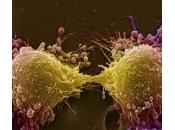 Andropausa, testosterone cancro alla prostata sono collegati loro