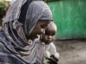 Torino /Comitato Collaborazione Medica mostra fotografica diritto alla salute dell'infanzia Africa