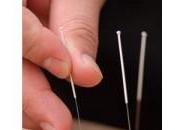 Agopuntura come aiuto patologie della prostata