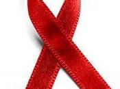 AIDS: studiano soggetti immuni trovare cura