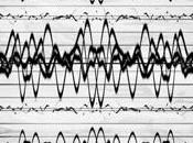 Epilessia disbiosi (passando vaccini radiazioni telefonino)
