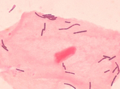 cellula procariote
