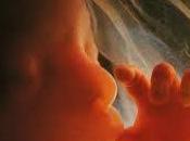 ÂŤChe importa l’aborto termina vita umana?Âť
