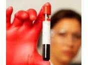 Nuovo test sangue rilevare cancro alla prostata