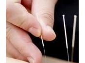 Agopuntura rimedio naturale contro prostatite
