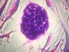 Cellule staminali: cura, legge questioni bioetiche