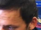 Kozak: “Mancato Loro sono forti”