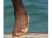LeBron James, campione dell’Nba piedi brutti (foto)