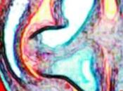 Intercettazioni Orecchio uccide Laporta)