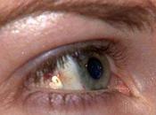 Tendenze: adesso impiantare gioiello negli occhi