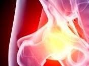 Frattura dell’anca: sintomi, cura, cause