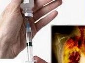 Cuba record della prima vaccinazione terapeutica contro cancro polmone