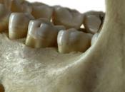 Indagine antichi denti microbi