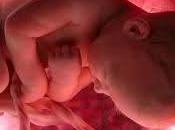 SCIENZA SENZA REGOLE Ottenuta crema antirughe feti umani abortiti