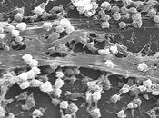 strutture biofilm loro importanza salute umana