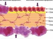 Cinque anni vita piu' bifosfonati
