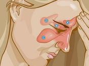 Sinunsite Sistema immunitario aiutarsi essenziali Salute