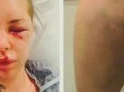 L'attuale dramma essere Come intervenire prima curare patologia "mollati"