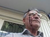 Nell’Iran Rouhani picchiato sangue giornalista dissidente Mohammad Nourizad [FOTO]