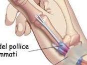 Quel dolore polso delle mamme