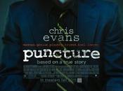 Puncture