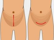 diamoci (altro) taglio