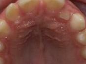 Quando canino spunta…