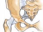 Forma, struttura tipologie protesi d’anca