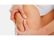 Cellulite: combatterla maniera naturale