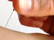 Domande Curiosità sull’Agopuntura (F.A.Q.)