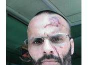 CASTELLO D’AGOGNA (pv). Stasera presidio sicurezza solidarietà Marco