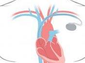 Conoscere prevenire patologie cardiovascolari cancro: proposta cammino insieme