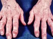 Artrite atrosi, Ascessi, Asma, trattarli essenziali