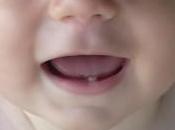 Dagli allerta prodotti lenitivi denti.