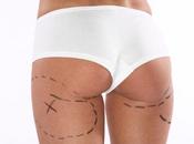 Prendi sempre Considerazione Prezzo Liposuzione