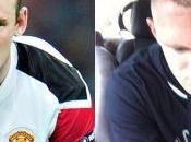 Rooney mostra nuova acconciatura dopo trapianto capelli