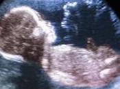 Alabama: aborto vietato dopo settimane dolore fetale