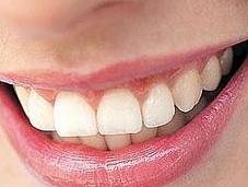 Denti perfetti ogni