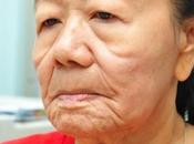 Sconvolgente: nguyen, anni, diventata vecchia pochi giorni