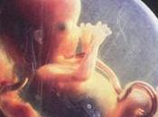 brevetti distruzione embrioni umani