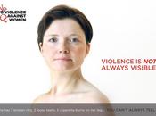 alla violenza contro donne. novembre 2011. mostra.