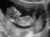 Texas, Corte d’Appello conferma: ecografia obbligatoria vuole abortire