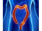 Idrocolonterapia
