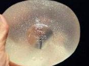 Protesi PIP: chirurghi denunciano società francese