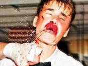 Justin Bieber massacrato foto copertina