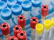 Test intolleraze alimentari: business milioni euro